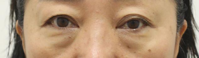 515b06054f8f8e2d3268921aa3bde34d_1756719475_4293.jpg 515b06054f8f8e2d3268921aa3bde34d_1756719475_4293.jpg