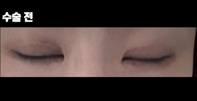 202404111708481241318826.png